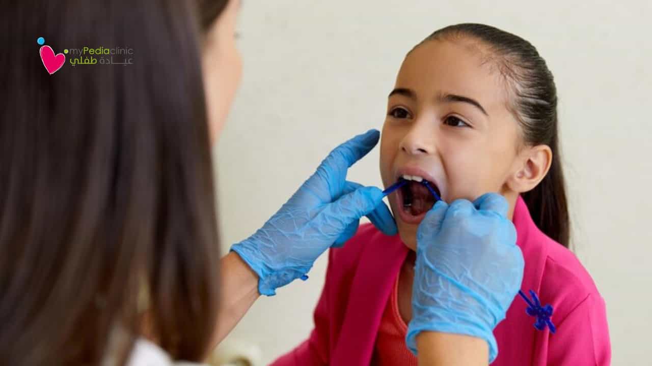Tongue Tie: Understand it and Learn More About its Benefits
